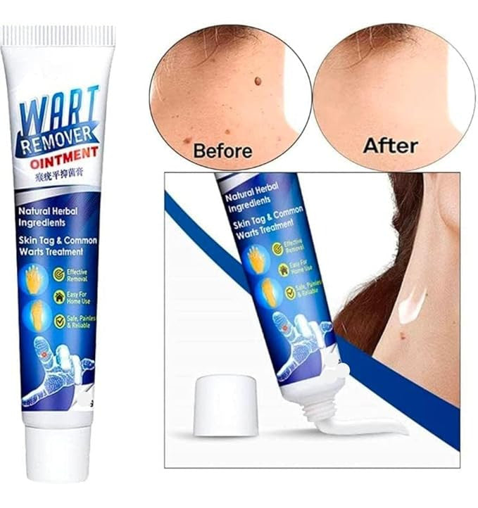 Wart Remover Gel_Buy 1, Get 1 Free